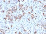 Prolactin (Pituitary Tumor Marker) Monoclonal Antibody (PRL/2642)