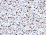 Prolactin (Pituitary Tumor Marker) Monoclonal Antibody (PRL/2643)