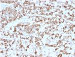 Prolactin (Pituitary Tumor Marker) Monoclonal Antibody (PRL/2910)