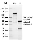 Prolactin (Pituitary Tumor Marker) Antibody in SDS-PAGE (SDS-PAGE)