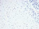 Prolactin (Pituitary Tumor Marker) Recombinant Rabbit Monoclonal Antibody (PRL/4908R)