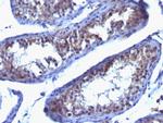 Prolactin Receptor (PRL-R) Monoclonal Antibody (SPM213)