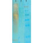 Acetylated Lysine Antibody in Western Blot (WB)