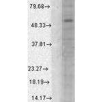 Alpha 1 GABA-A Receptor Antibody in Western Blot (WB)