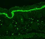 Phosphotyrosine Antibody in Immunohistochemistry (Paraffin) (IHC (P))
