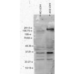 Phosphotyrosine Antibody in Western Blot (WB)