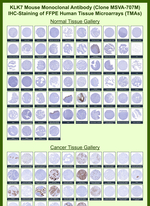 KLK7 (Kallikrein Related Peptidase 7) Monoclonal Antibody (MSVA-707M)