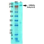 Ankyrin-B Antibody in Immunocytochemistry (ICC/IF)