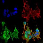 Ankyrin-B Antibody in Immunocytochemistry (ICC/IF)