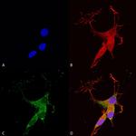 VGlut3 Transporter Antibody in Immunocytochemistry (ICC/IF)
