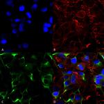 SNAT1 Neurotransmitter Transporter Antibody in Immunocytochemistry (ICC/IF)