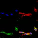mGluR1/5 Glutamate Receptor Antibody in Immunocytochemistry (ICC/IF)