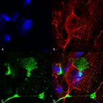 LRP4 (extracellular) Antibody in Immunocytochemistry (ICC/IF)