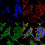 GluN2A/NR2A Antibody in Immunocytochemistry (ICC/IF)