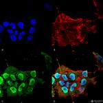 Ataxin-1 Antibody in Immunocytochemistry (ICC/IF)