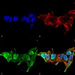 Mitofusin-2 Antibody in Immunocytochemistry (ICC/IF)