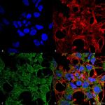GABARAP Antibody in Immunocytochemistry (ICC/IF)