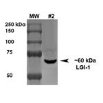 Leucine-Rich Glioma Inactivated Gene 1 (LGI1) Antibody in Western Blot (WB)