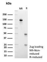 MUC13/Mucin 13 Antibody in SDS-PAGE (SDS-PAGE)