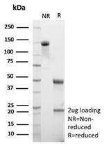 MUC13/Mucin 13 Antibody in SDS-PAGE (SDS-PAGE)