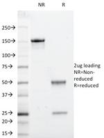 Beta-2 Microglobulin (Renal Failure and Tumor Marker) Antibody in SDS-PAGE (SDS-PAGE)