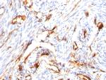 Beta-2 Microglobulin Antibody in Immunohistochemistry (Paraffin) (IHC (P))