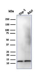Beta-2 Microglobulin Antibody in Western Blot (WB)