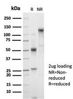 Beta-2 Microglobulin (Renal Failure and Tumor Marker) Antibody in SDS-PAGE (SDS-PAGE)