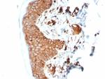 Beta-2 Microglobulin (Renal Failure and Tumor Marker) Antibody in Immunohistochemistry (Paraffin) (IHC (P))