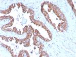 PMEPA1/TMEPAI (Tumor Suppressor Oncoprotein) Monoclonal Antibody (PMEPA1, 2696)