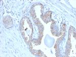 PMEPA1/TMEPAI (Tumor Suppressor Oncoprotein) Monoclonal Antibody (PMEPA1, 2697)