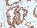 PMEPA1/TMEPAI (Tumor Suppressor Oncoprotein) Monoclonal Antibody (PMEPA1, 2698)