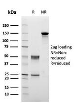 PMEPA1/TMEPAI (Tumor Suppressor Oncoprotein) Antibody in SDS-PAGE (SDS-PAGE)