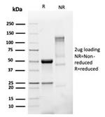 PMEPA1/TMEPAI (Tumor Suppressor Oncoprotein) Antibody in SDS-PAGE (SDS-PAGE)