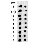 Amyloid Fibrils Antibody in Dot Blot (DB)