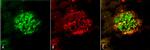 Amyloid Fibrils Antibody in Multiplex Immunohistochemistry (mIHC)