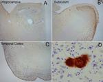 Amyloid Fibrils Antibody in Immunohistochemistry (IHC)