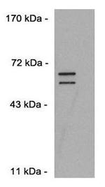 DUX4 Antibody in Western Blot (WB)