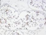 DUX4 Antibody in Immunohistochemistry (Frozen) (IHC (F))