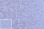 SALL-4 (Metastatic Germ Cell Tumor Marker) Monoclonal Antibody (SALL4/12615)