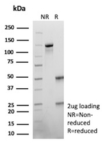 SALL-4 (Metastatic Germ Cell Tumor Marker) Antibody in SDS-PAGE (SDS-PAGE)