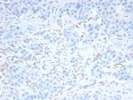 SALL-4 (Transcription Factor) Recombinant Rabbit Monoclonal Antibody (SALL4/7802)