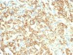 S100A14 (S100 calcium binding protein A14) Antibody in Immunohistochemistry (Paraffin) (IHC (P))