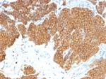 Parathyroid Hormone (PTH) Monoclonal Antibody (3H9)