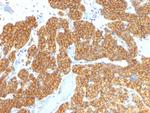 Parathyroid Hormone (PTH) Monoclonal Antibody (PTH/911)