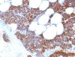 Parathyroid Hormone (PTH) Antibody in Immunohistochemistry (Paraffin) (IHC (P))