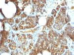 Parathyroid Hormone (PTH) Monoclonal Antibody (PTH/1173)
