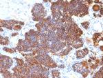 Parathyroid Hormone (PTH) Monoclonal Antibody (PTH/1174)