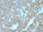 Parathyroid Hormone (PTH) Monoclonal Antibody (PTH/1175)