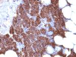 Parathyroid Hormone (PTH) Monoclonal Antibody (3H9, PTH/1175)